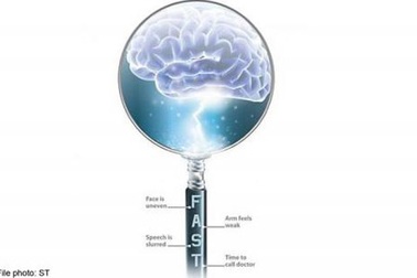 9 cách để giảm nguy cơ đột quỵ