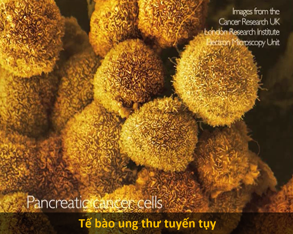 Cận cảnh hình hài những tế bào “chết chóc nhất mà con người từng biết đến - 8 Cận cảnh hình hài những tế bào “chết chóc nhất mà con người từng biết đến - 8