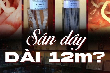 Độc lạ nơi lưu giữ những sinh vật dài hàng mét từng sống trong cơ thể người