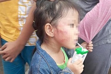 Những vụ bạo hành trẻ mầm non xôn xao dư luận năm 2018