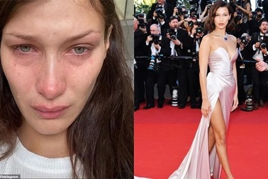 Siêu mẫu Bella Hadid bất ngờ chia sẻ loạt ảnh đẫm nước mắt