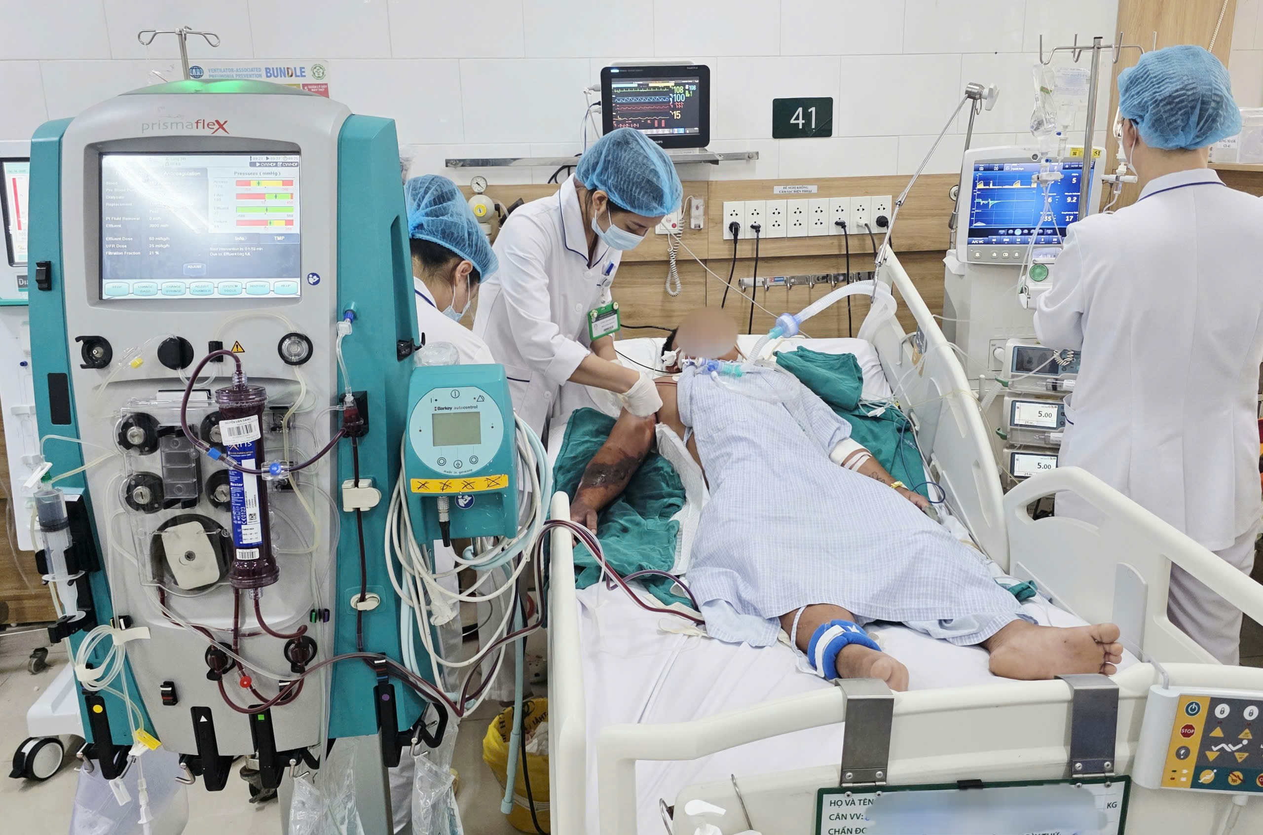 Xử lý sai cách khi bị rắn hổ mang cắn, người đàn ông không qua khỏi  - 1