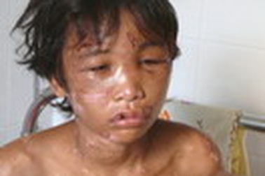 Cử luật sư miễn phí cho cháu bé bị hành hạ như “thời trung cổ”