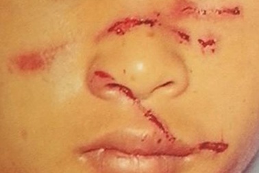 Để lạc mất trâu, con trai bị bố đánh dã man