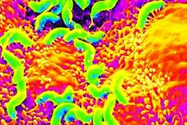 Nguy cơ ung thư từ vi khuẩn HP