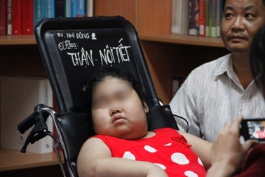 Tưởng bị béo phì, không ngờ bé gái mắc bệnh cực hiếm