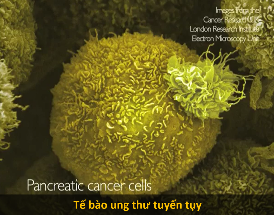 Cận cảnh hình hài những tế bào “chết chóc nhất mà con người từng biết đến - 7 Cận cảnh hình hài những tế bào “chết chóc nhất mà con người từng biết đến - 7