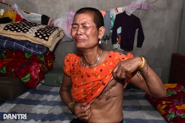 Người phụ nữ góa bụa mắc 2 bệnh nan y mong được cứu giúp