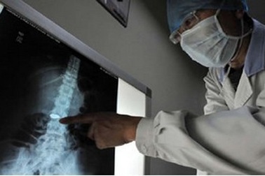 Nuốt cả sợi dây chuyền vào bụng