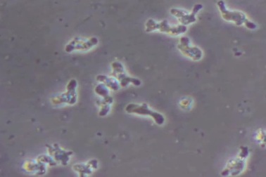 Du khách tử vong vì sinh vật “ăn não” khi bơi ở công viên nước