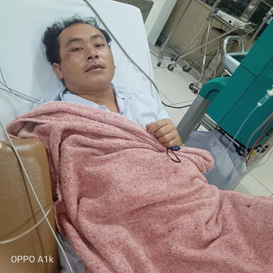 Bác sĩ khẩn thiết mong bạn đọc dang tay cứu mạng gia đình ngộ độc nấm rừng - 3 Bác sĩ khẩn thiết mong bạn đọc dang tay cứu mạng gia đình ngộ độc nấm rừng - 3