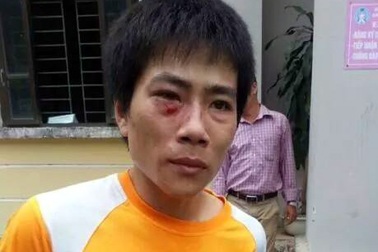 Hà Nội: Cao thủ trộm gương xế xịn hung hăng chống lại công an