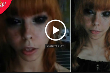 Xăm đen lòng mắt, người mẫu 25 tuổi nhận tin dữ sẽ bị mù hoàn toàn