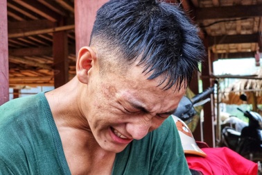 Người lính bị đinh cắm xuyên chân khi tìm thi thể tại Làng Nủ