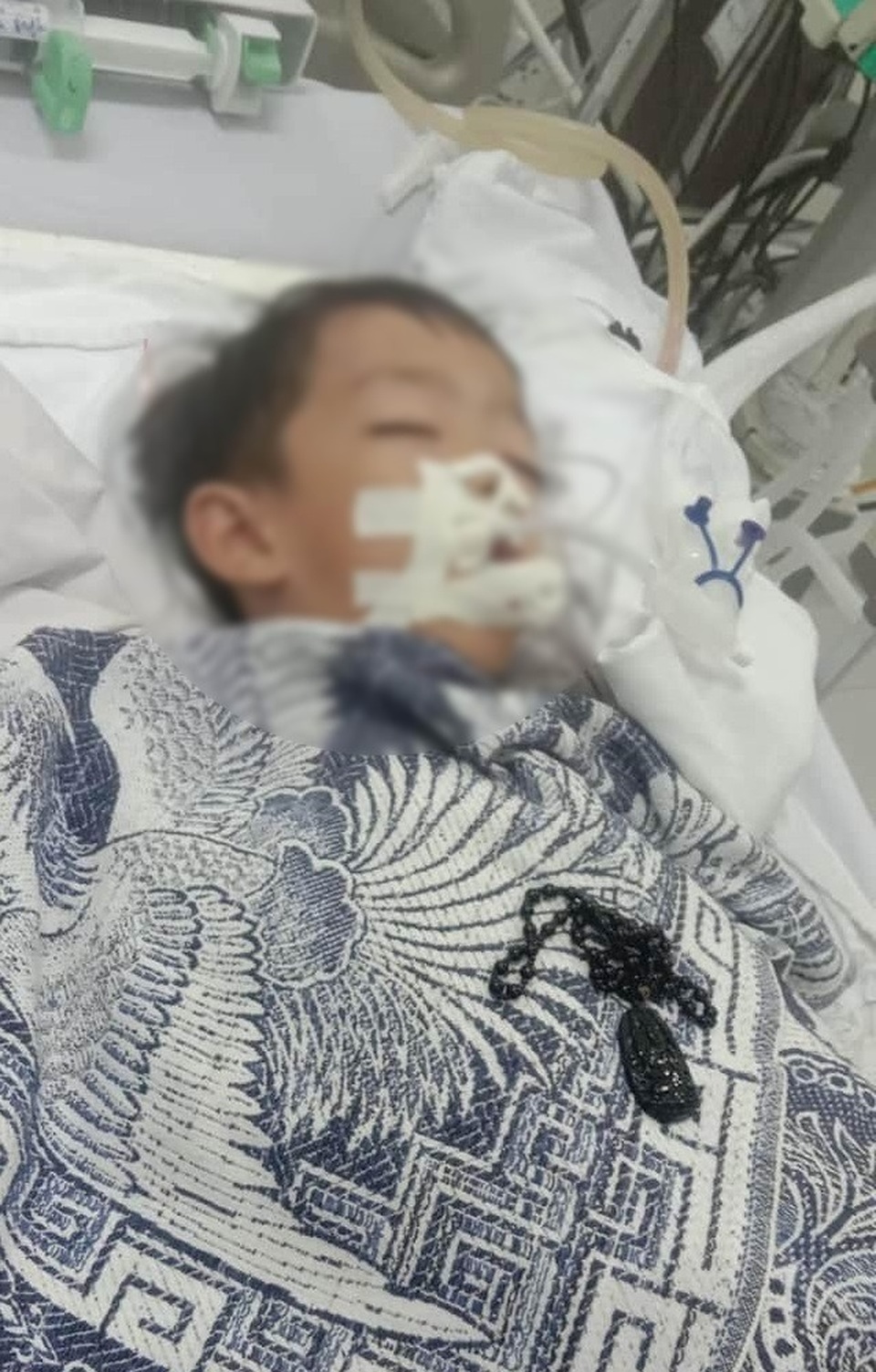 Vụ bé trai tử vong sau tiểu phẫu: Giải phẫu tử thi tìm nguyên nhân - 2 Vụ bé trai tử vong sau tiểu phẫu: Giải phẫu tử thi tìm nguyên nhân - 2