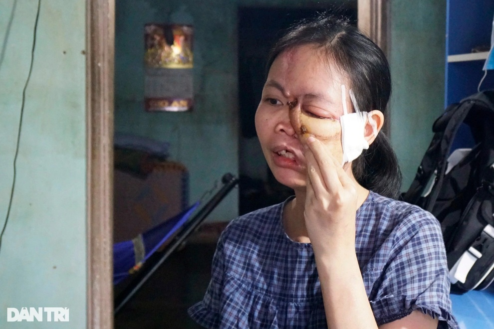 Cô gái đau khổ bởi hễ ra đường là trẻ con vừa thấy đã khóc thét, bỏ chạy - 3 Cô gái đau khổ bởi hễ ra đường là trẻ con vừa thấy đã khóc thét, bỏ chạy - 3