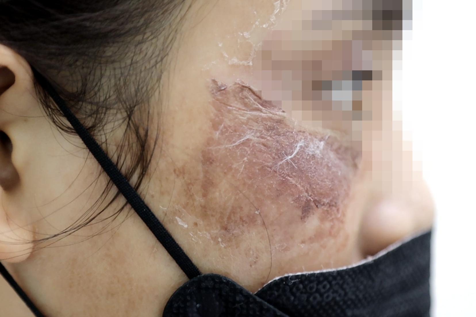 Hiểm họa vì thói quen mua mỹ phẩm, kem bôi da theo trend trên mạng - 2