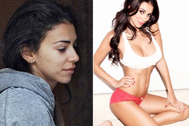 Mỹ nhân gợi tình nhất thế giới lộ mặt đầy mụn