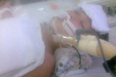 Mũi tiêm định mệnh và cái chết của em bé 3 tuổi