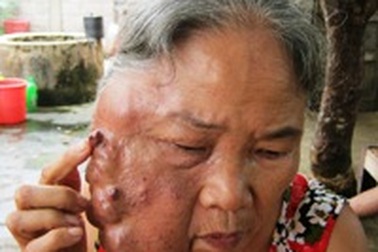 Nỗi thống khổ của người phụ nữ muốn chết cũng không xong!