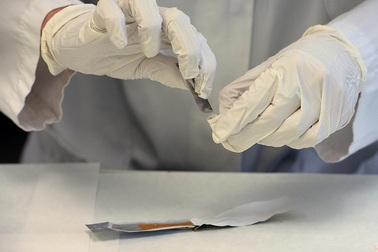 Phát hiện: Trầm cảm liên quan với tâm thần phân liệt