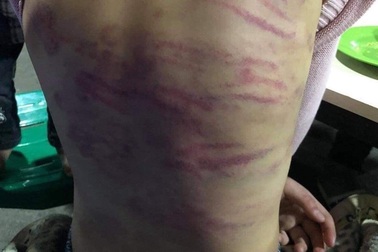 Khởi tố bị can trong vụ hiếp dâm con riêng của "vợ hờ" ở Hà Đông, Hà Nội