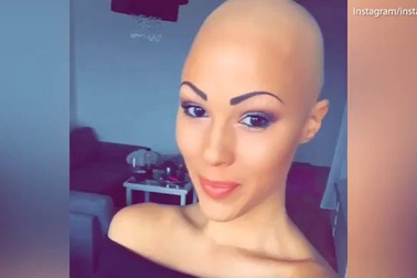 Người mẫu “hói” ăn khách với vẻ đẹp khác lạ