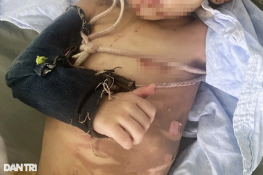 Cấp cứu bé 2 tuổi ở TPHCM người đầy vết thương, nghi bị cha bạo hành 3 ngày