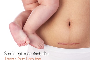 Bí quyết xua tan nỗi lo về sẹo