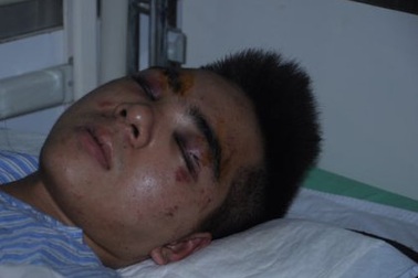 Nam sinh viên bị “ma cũ” đánh dã man giữa ký túc xá