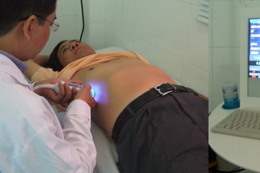 Tư vấn, khám miễn phí bệnh phình động mạch chủ bụng