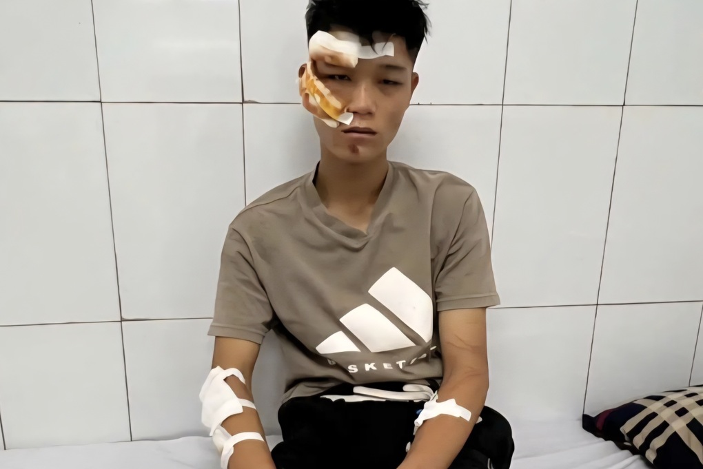 Vụ thông chốt bảo vệ A80: Khởi tố vụ án, điều tra tội giết người - 1