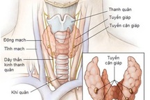 Các phương pháp điều trị u tuyến cận giáp