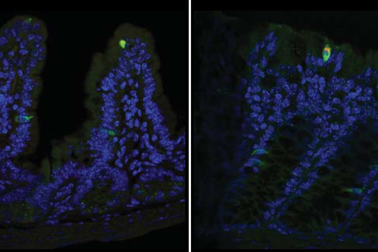 Đây là cách Norovirus xâm chiếm cơ thể