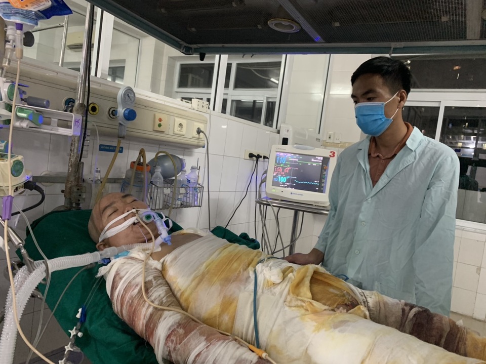 Đau nhói lòng cảnh người mẹ đi kiếm cái ăn nuôi 3 con bị ngã vào bếp hấp cá - 5 Đau nhói lòng cảnh người mẹ đi kiếm cái ăn nuôi 3 con bị ngã vào bếp hấp cá - 5