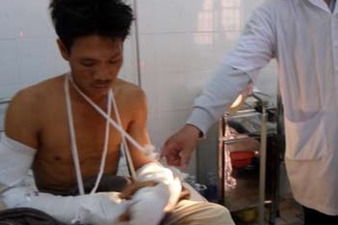 Đắk Lắk: Nối ghép thành công 2 trường hợp đứt lìa tay