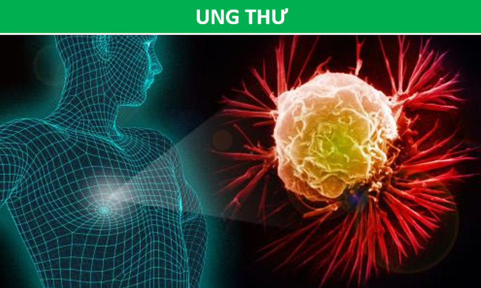 Ngày nào cũng nấc cụt có thể là dấu hiệu của bệnh lý nghiêm trọng - 3 Ngày nào cũng nấc cụt có thể là dấu hiệu của bệnh lý nghiêm trọng - 3