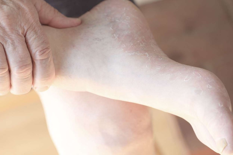 Bàn chân tiết lộ 10 dấu hiệu kín đáo của bệnh - 1 Bàn chân tiết lộ 10 dấu hiệu kín đáo của bệnh - 1