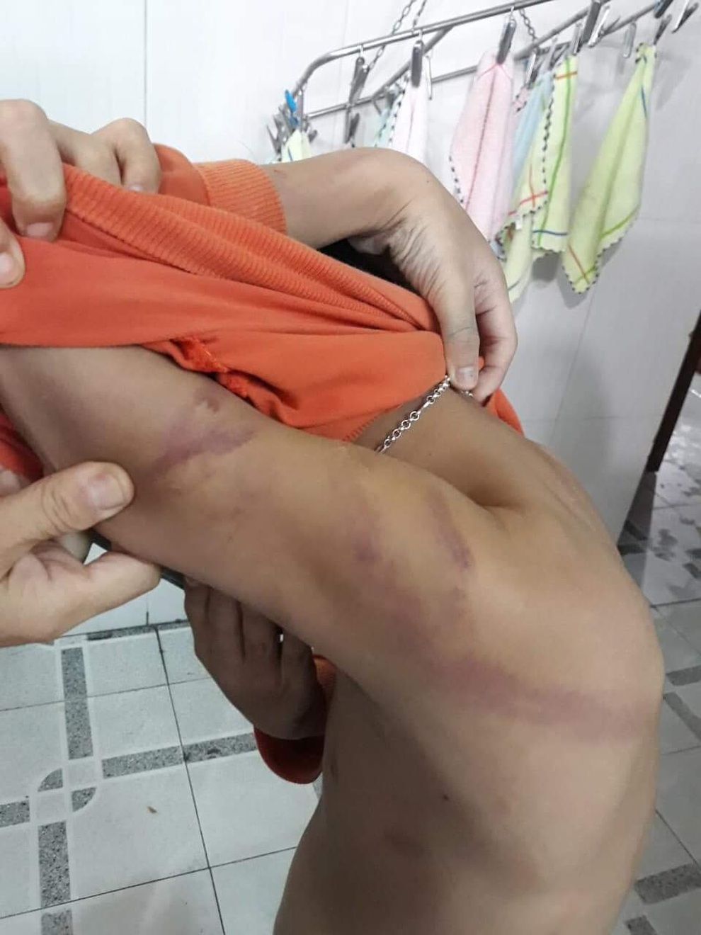 Cha đánh con lớp 1 thâm tím vì học không tiến bộ - 2 Cha đánh con lớp 1 thâm tím vì học không tiến bộ - 2