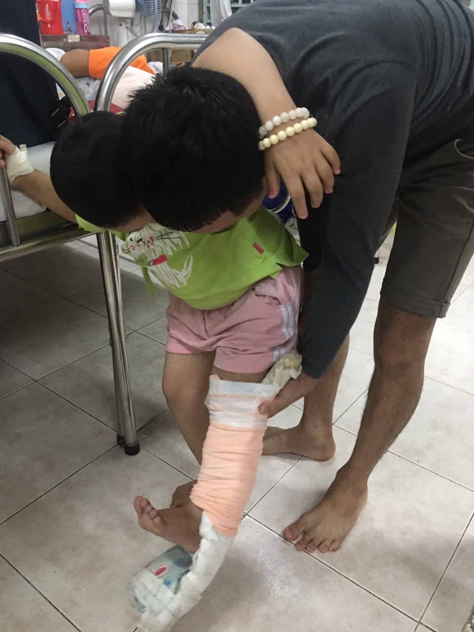 Xót xa số phận bé gái nghèo nguy cơ phải cưa chân vì u xương quái ác - 4 Xót xa số phận bé gái nghèo nguy cơ phải cưa chân vì u xương quái ác - 4