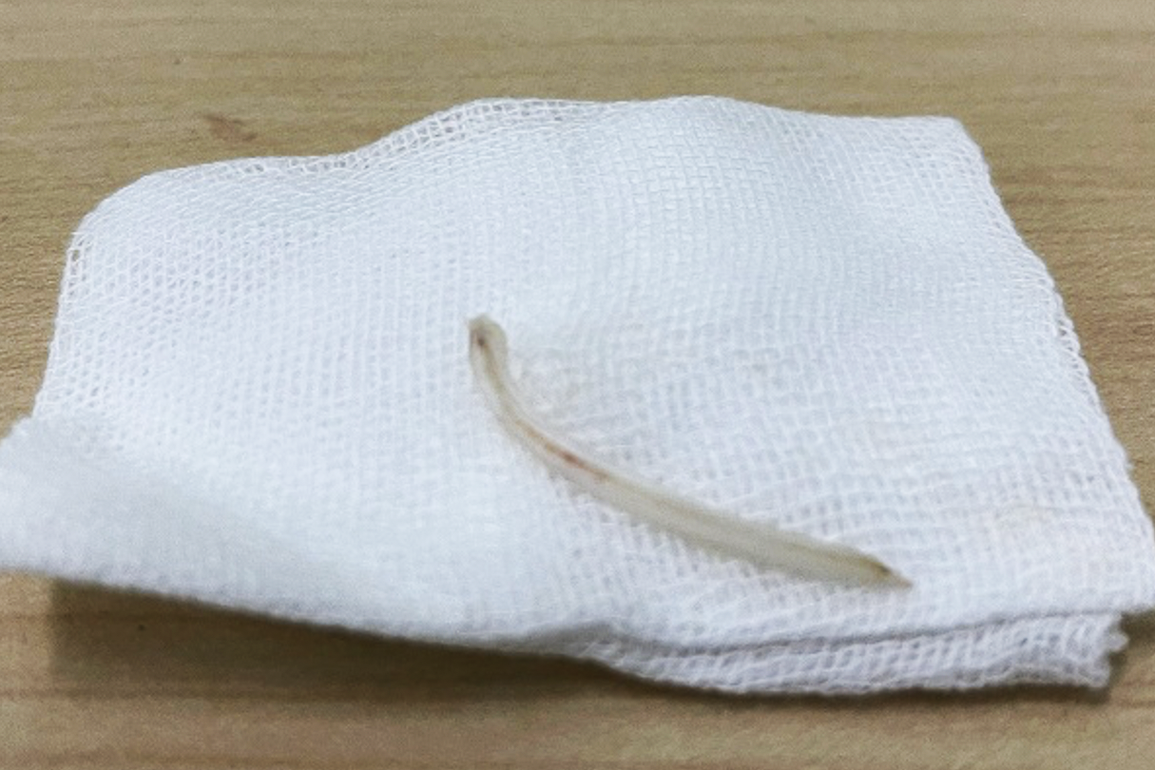 Đỡ cháu ngoại bị té, người đàn ông suýt chết khi đang ăn cá điêu hồng - 2