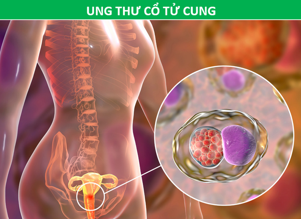 Những phương pháp tầm soát ung thư giúp bạn chủ động trước bệnh tật - 3 Những phương pháp tầm soát ung thư giúp bạn chủ động trước bệnh tật - 3