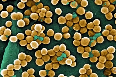 Nghiên cứu phát hiện đèn tia UV có thể tiêu diệt virus cúm trong không khí