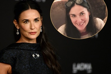 “Người đẹp không tuổi” tiết lộ bị… rụng răng vì căng thẳng