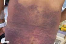 Thông tin mới sức khỏe thanh niên vụ uống nước "lạ" bị bán sang Campuchia