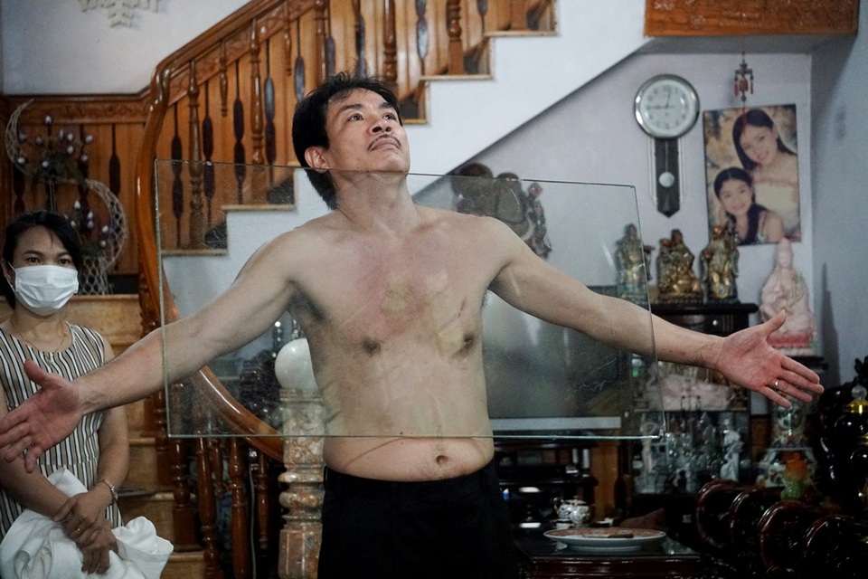 Kỳ lạ người đàn ông như nam châm khổng lồ, hút chặt các đồ vật vào cơ thể - 4