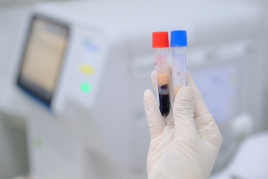 Căn bệnh nguy hiểm khiến máu bệnh nhân đục như sữa