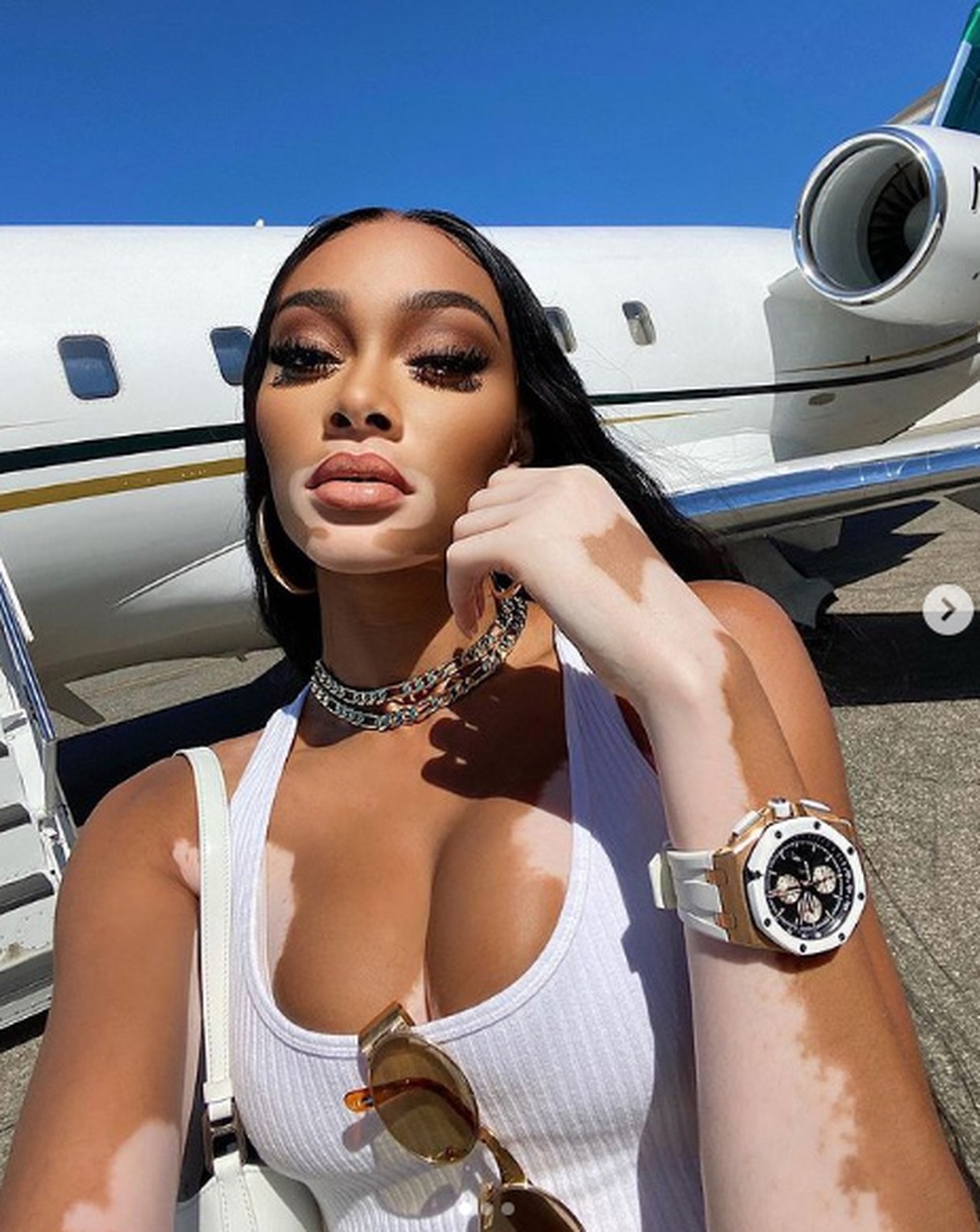 Siêu mẫu bạch biến Winnie Harlow gây choáng với váy xẻ bất tận - 7 Siêu mẫu bạch biến Winnie Harlow gây choáng với váy xẻ bất tận - 7