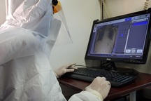 Phổi phi công người Anh nhiễm Covid-19 phục hồi 30%