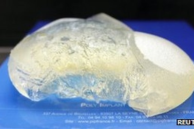 Pháp: 30.000 phụ nữ có thể phải bỏ túi cấy nâng ngực